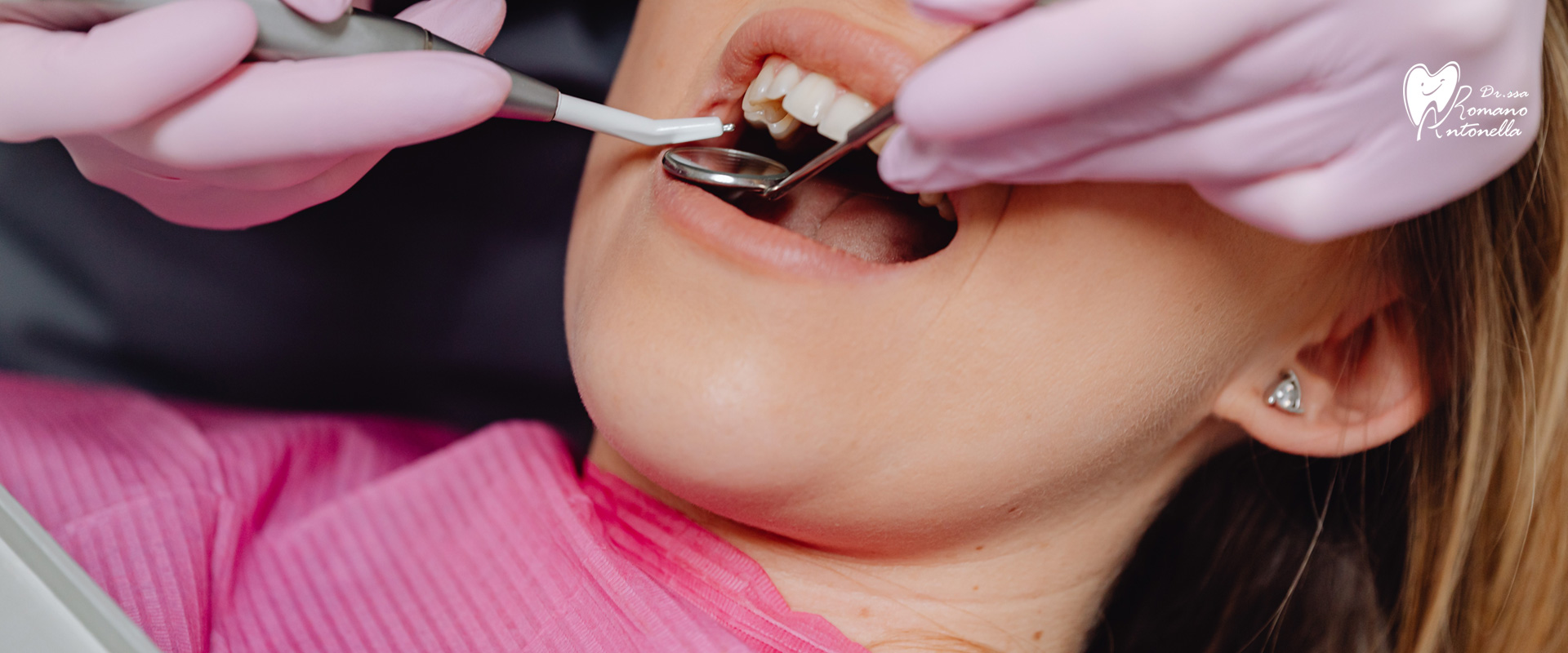 CHECK UP DENTALE